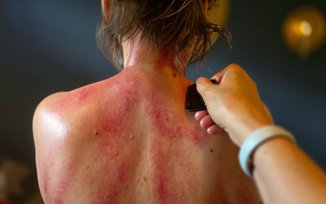Gua Sha – mehr als nur Schaben